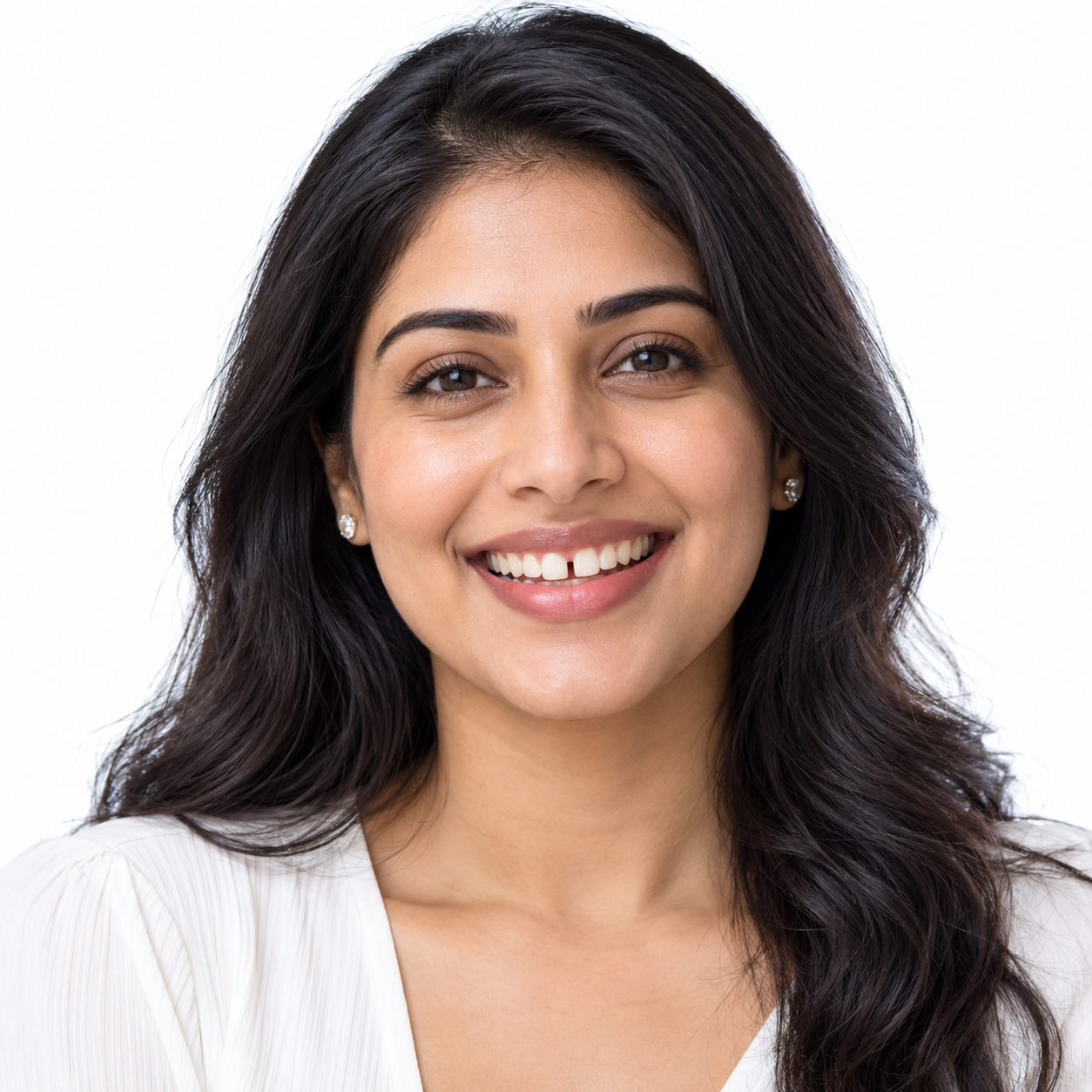 Tooth Gap Correction